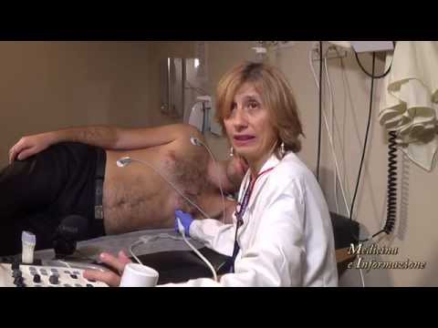 Video: Differenza Tra ECG Ed Ecocardiogramma
