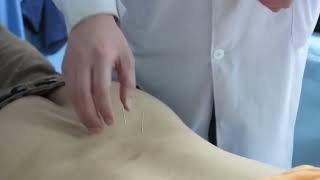 Medical Acupuncture Learning at China Shifang city Chengdu #acupuncture #chna #TCM #traditional