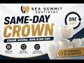 Same-Day Crown in ONE Visit?! 🦷 No Temporary Needed!