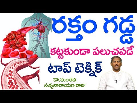రక్తం గడ్డకట్టకుండా పల్చబడాలంటే?| Blood Thinner | Dr Manthena Satyanarayana Raju Videos| GOOD HEALTH