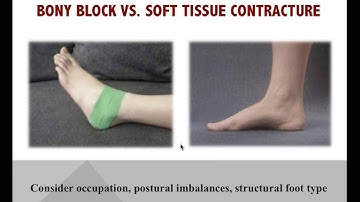 Beyond Stretching! Trigger Points & Limited Ankle Mobility with Dr Emily Splichal