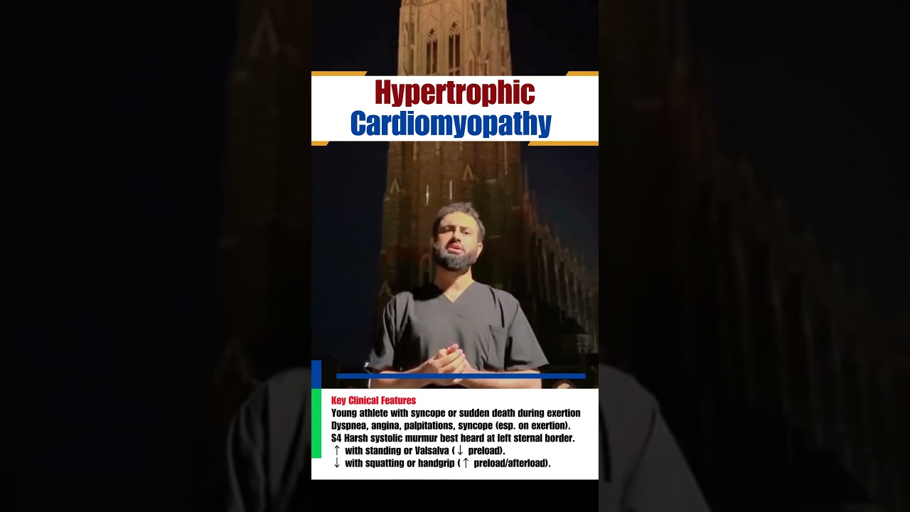 Hypertrophic Cardiomyopathy | Exam Key Points | Dr Hafiz Atif | AMC, NRE, USMLE-2CK, JCAT, FCPS, SLE