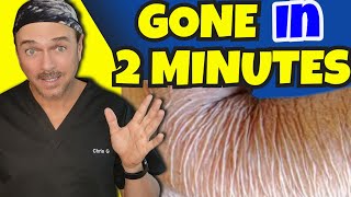 2 Minute Fix For Crepey Skin That Actually Works Chris Gibson