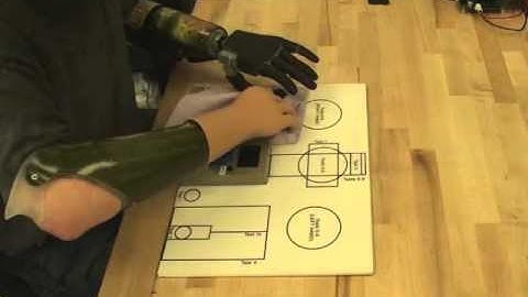 Multigrasp Myoelectric Control of Vanderbilt Multigrasp Hand Prosthesis, Part II