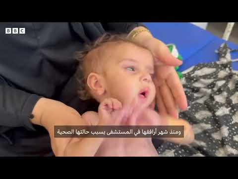 الأمم المتحدة تدعو لاتخاذ إجراءات عاجلة بشأن ارتفاع وفيات الأطفال