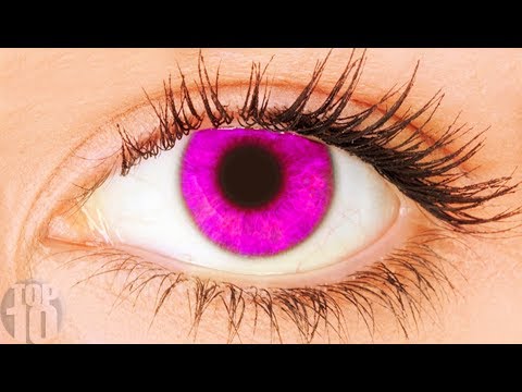 11 Rarest Eye Colors In Humans