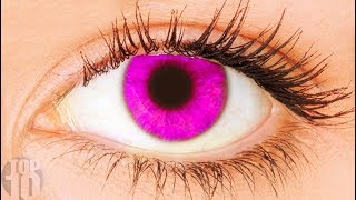 Download 11 Rarest Eye Colors In Humans Video MP3 11 Rarest Eye Colors In Humans