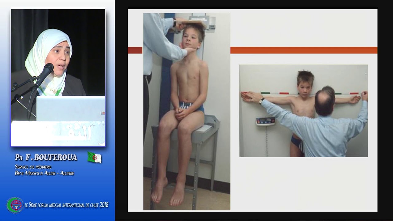 Pr F.BOUFEROUA Service de pédiatrie  A CHU Beni-Messous.