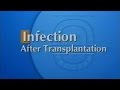 Infection after transplantation