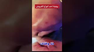 شايف بيض القرش ؟