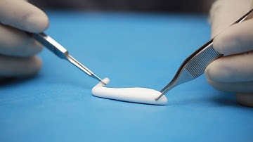 Sụn nâng mũi NanoForm có gì đặc biệt?