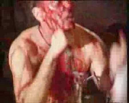 Haemorrhage-Mortuary Riot