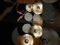 Zildjian | A Custom Setups