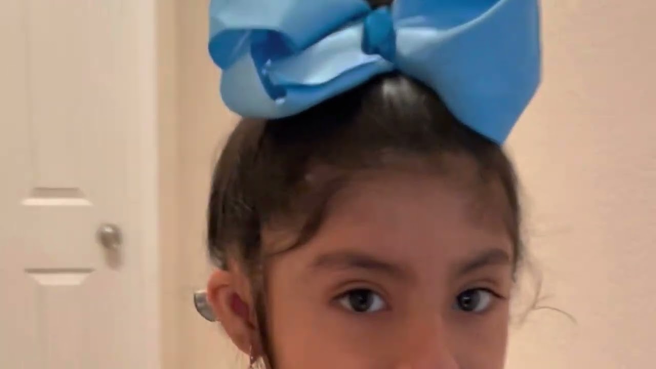 Microtia Awareness Day 💙!!