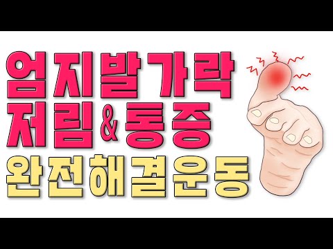 엄지발가락 통증 저림 원인과 완전해소 스포츠 재활교정 이완 스트레칭 운동(feat 발가락 관절 엉덩이통증 다리저림 좌골신경통 연관성)