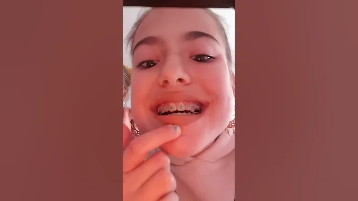 voil la partie 2