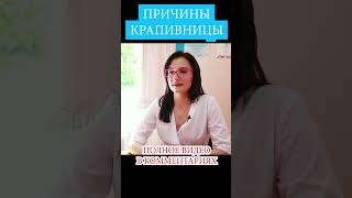 Крапивница 📌 Причины крапивницы. От чего крапивница у детей и взрослых