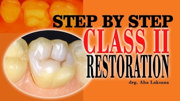 Step by Step Class II Direct Composite Restoration | Operative Dentistry (Polofil® NHT - VOCO GmbH)
