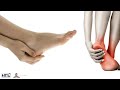 How To Increase Blood Flow & Circulation To Your Feet?