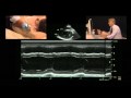 M-Mode Measurement of the Left Ventricle