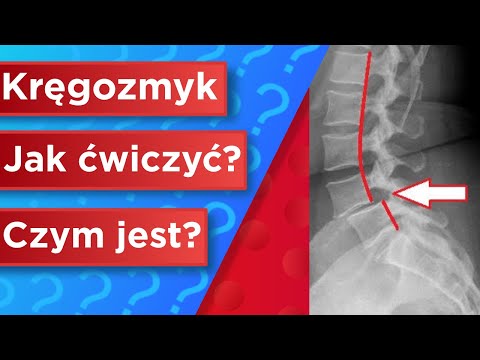 Kregozmyk - czym jest? Jakie ćwiczenia wykonywać?