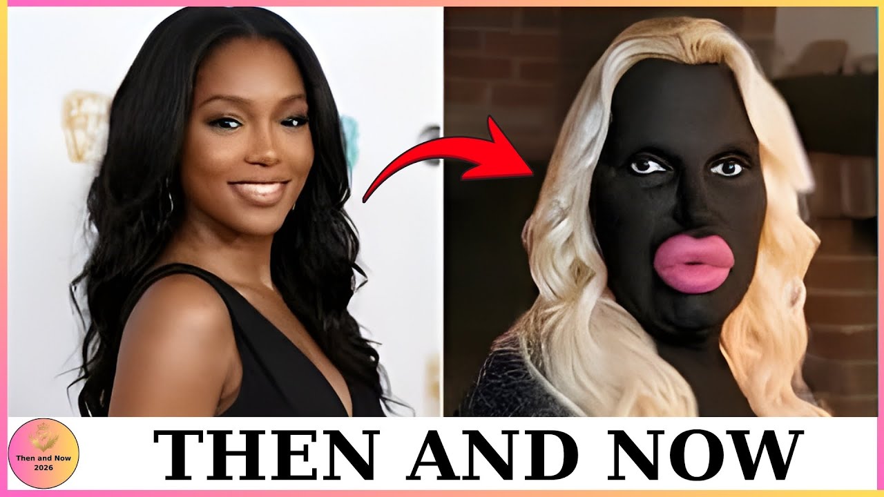 15 чернокожих знаменитостей, которые сожалеют о своем решении сделать пластическую операцию | Тог...