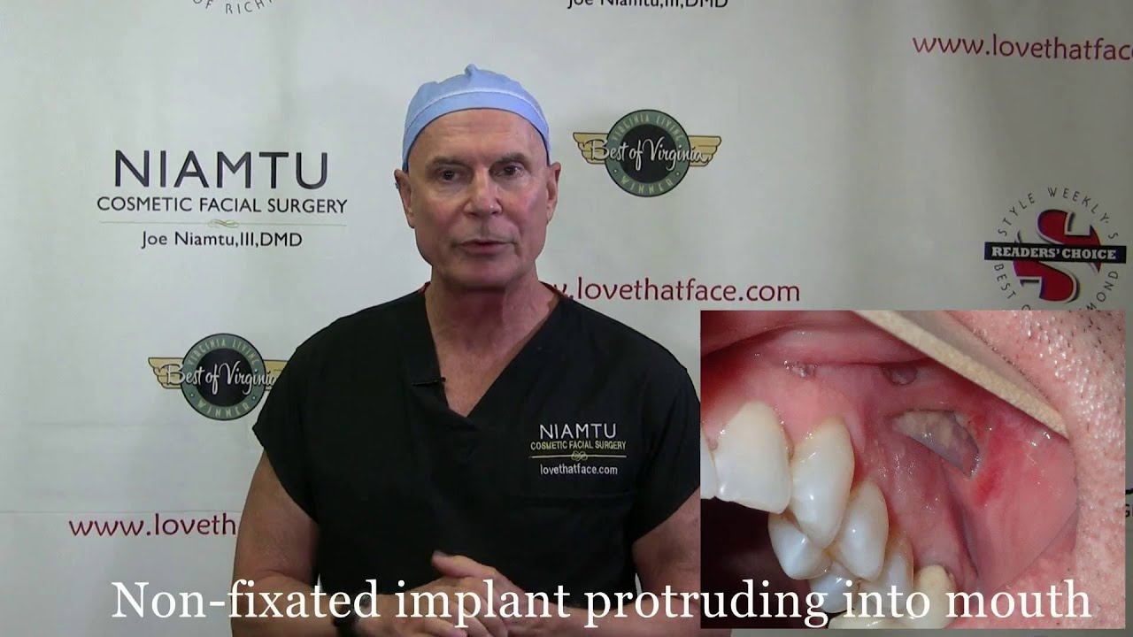 Infected Cheek Implant by Dr. Joe Niamtu, III YouTube