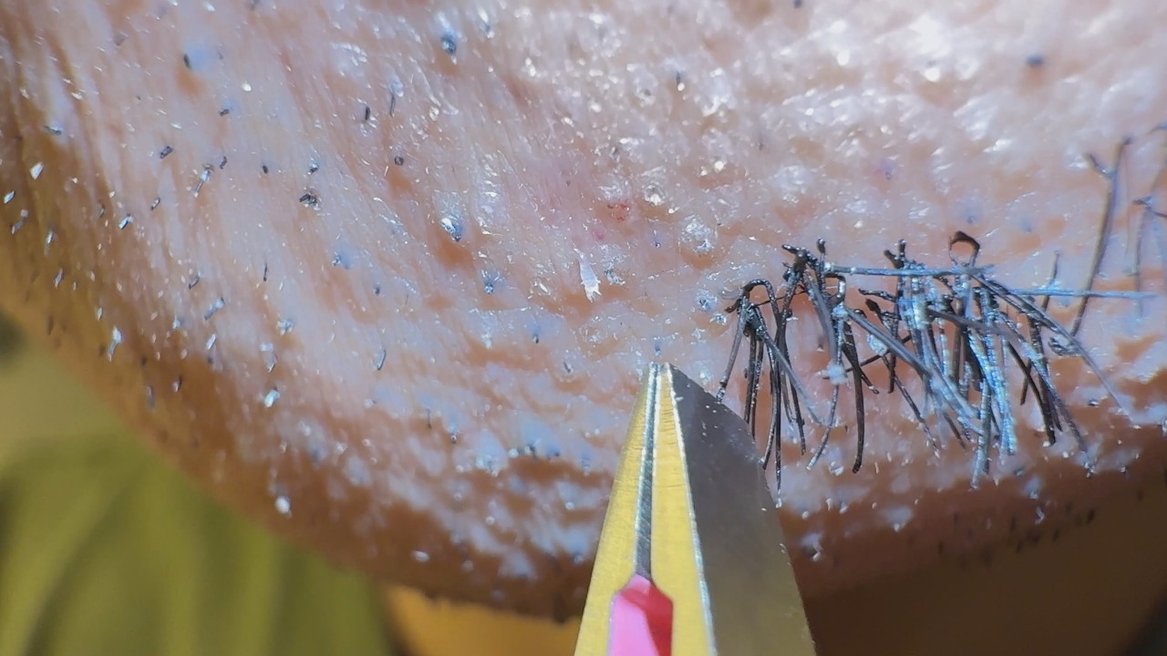 Plucking facial hair 1475 顎髭抜き