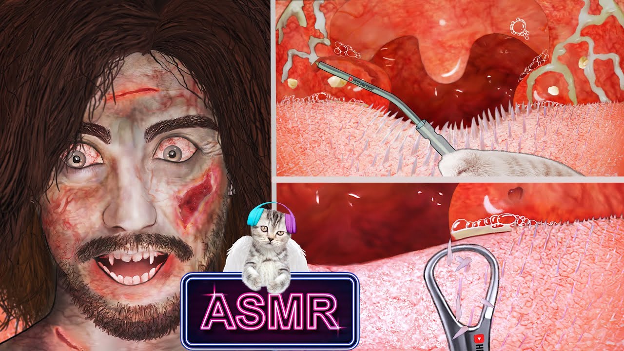 [ASMR] zombie tonsil stones / Tonsillitis Treatment Animation /asmr / 좀비 편도결석 / 편도선염 치료 애니메이션 asmr