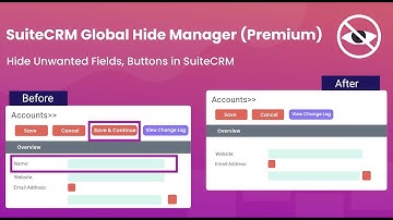 SuiteCRM Global Hide Manager Premium