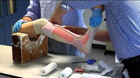 6. Close Contact Casting (CCC):  Application technique demo