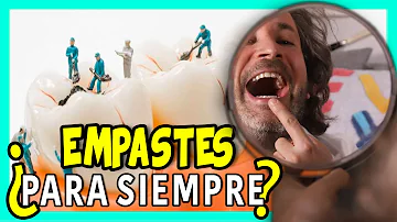 ¿Qué empastes duran más?