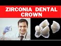 Zirconia Crown—HINDI—DENTAL CAP/CROWNS