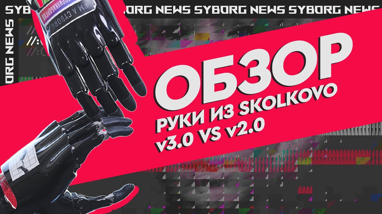 Обзор нового прототипа протеза руки из Skolkovo | Vlog промышленный дизайн 3D печать  индустрия 4.0