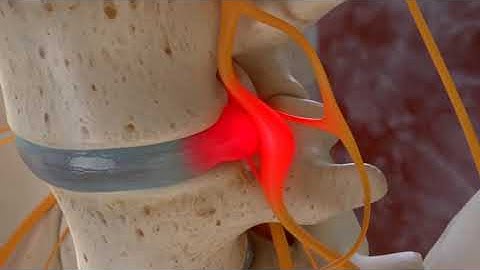 BoneScalpel Animation