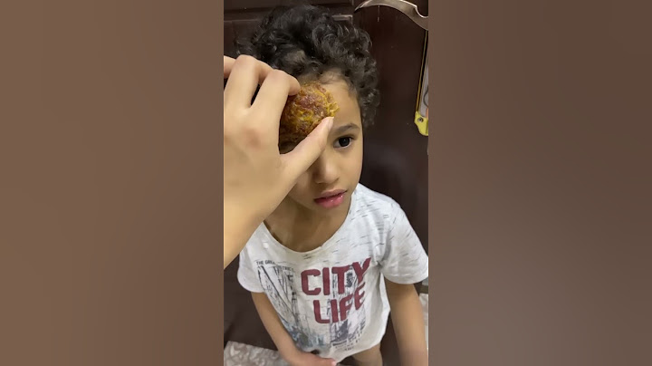 شلنا الدوا من راس عبودي