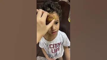 شلنا الدوا من راس عبودي 