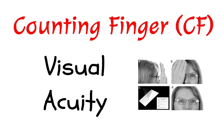 Counting Finger (CF) Visual Acuity Measurement