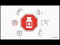 Ectopic Pregnancy Treatment: Medical (Methotrexate) vs. Surgical Management