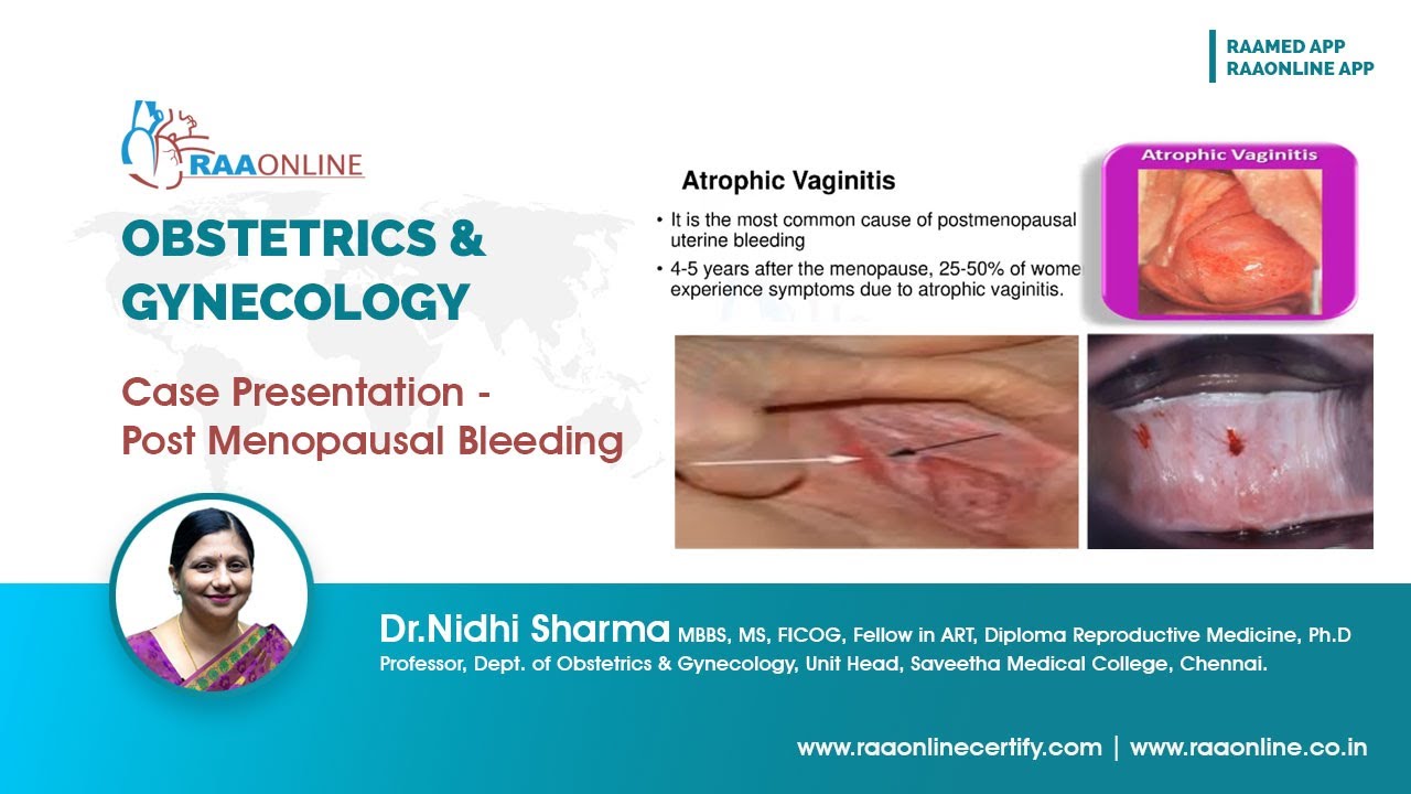 Case Presentation - Post Menopausal Bleeding - MD/DNB Obstetrics &  Gynaecology 