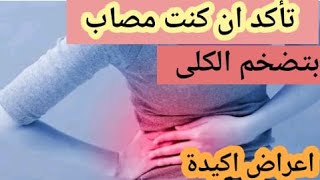 تأكد ان كنت مصاب بتضخم الكلى اعراض اكيدة 2021