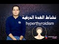 نشاط الغدة الدرقية / hyperthyroidism