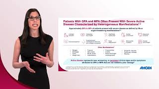 Diagnosing Severe Active Anca-Ociated Vasculitis Importance Of Clinical Essment In Gpa & Mpa