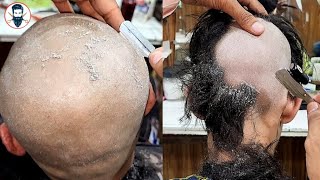 Head Shave👌Top 2 V'S Dandruff Remove Complete Solution for Men's? Attractive Dandruff Remove Shave👍