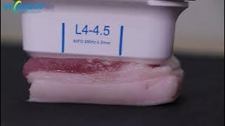 Testing on pork by hifu shot (HCBEAUTY 7d HIFU)
