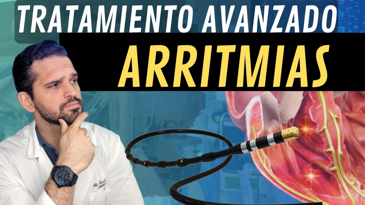 !MIRA¡ Asi es un Estudio ELECTROFISIOLÓGICO y ABLACIÓN en arritmias 💥