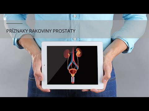 Video: Rakovina Prostaty - Príčiny, Príznaky, štádiá, Diagnostika, Liečba