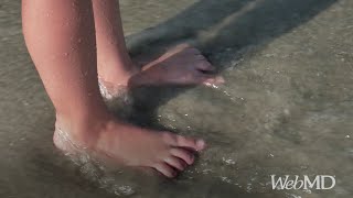 What Your Feet Say About Your Health | WebMD