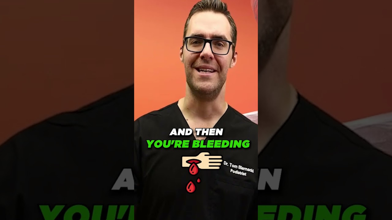 What Helps Circulation in Diabetic Feet? [ Angioplasty & Stent & Risk, Foot HELP! ]