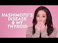 How My Hashimoto's Disease Affects My Appearance (Hypothyroid Symptoms) | Skincare with @Susan Yara
